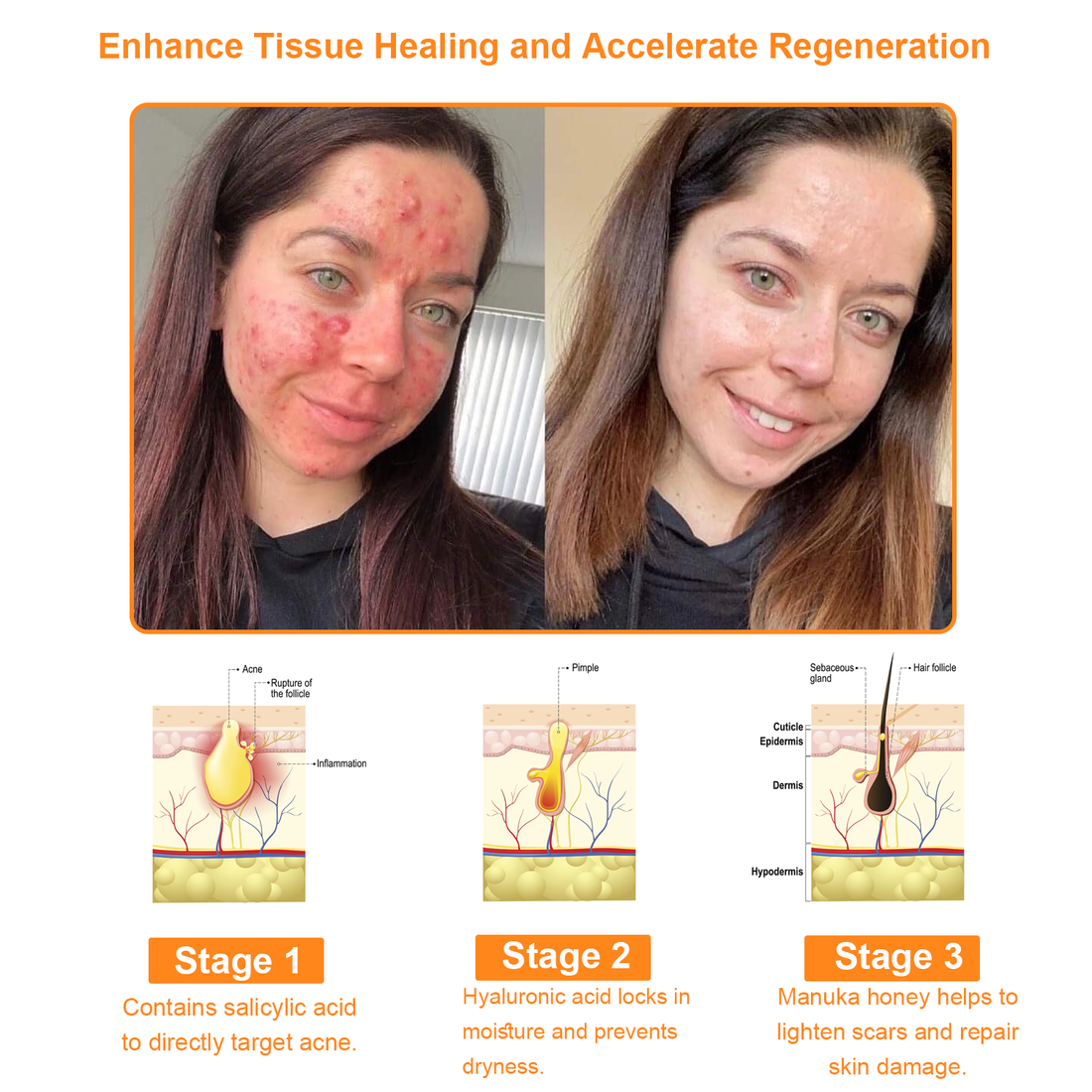 CREMA BEE VENOM POTENTE PARA TODO EL CUERPO x 60 ML